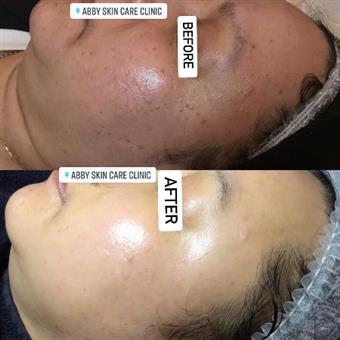 ABBY SKIN CLINIC & FFMS MEDICAL SPA INC. - Union City CA | Vagaro