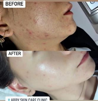 Reviews of ABBY SKIN CLINIC & FFMS MEDICAL SPA INC. - union city CA